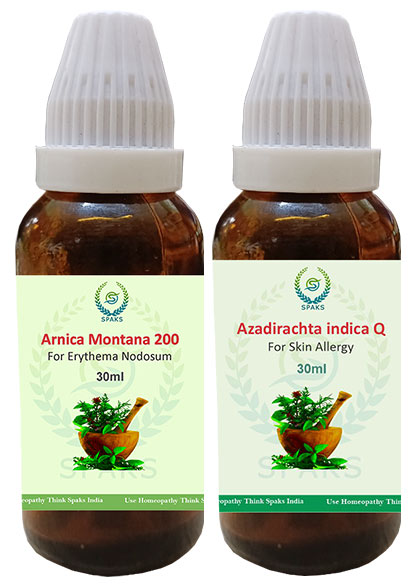 Arnica Mon. 200 , Azadirachita ind. Q For Erythema Nodosum