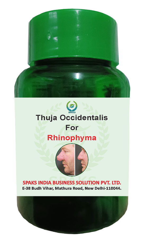 Thuja Occ. 200, Sangulnaria Can Q For Rhinophyma